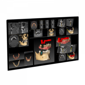 Owandy Quickvision 3D Implant Planning