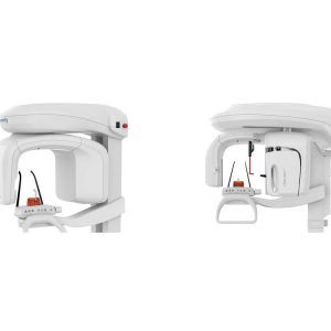 Panoramic X-Ray